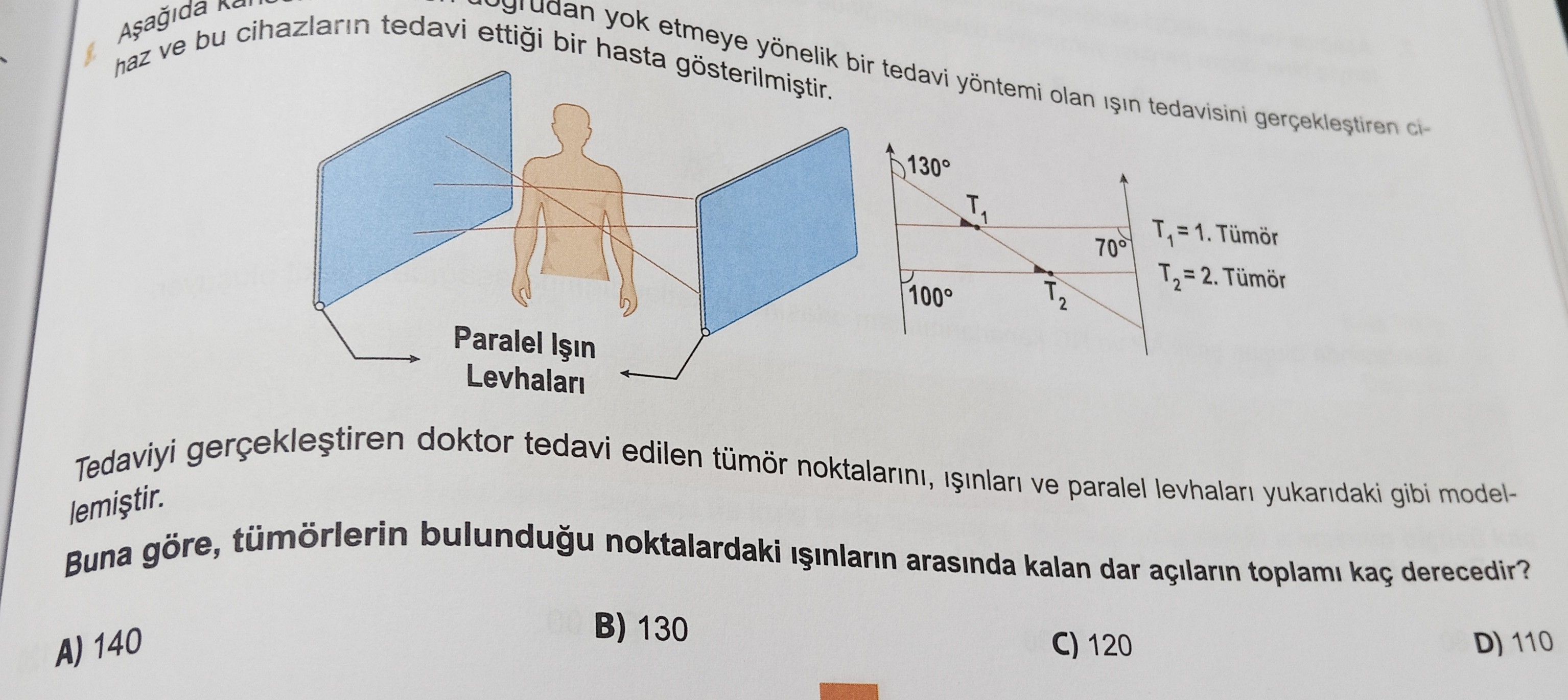 Aşağıda kance... doğrudan yok etmeye yönelik bir tedavi yöntemi olan ışın tedavisini gerçekleştiren