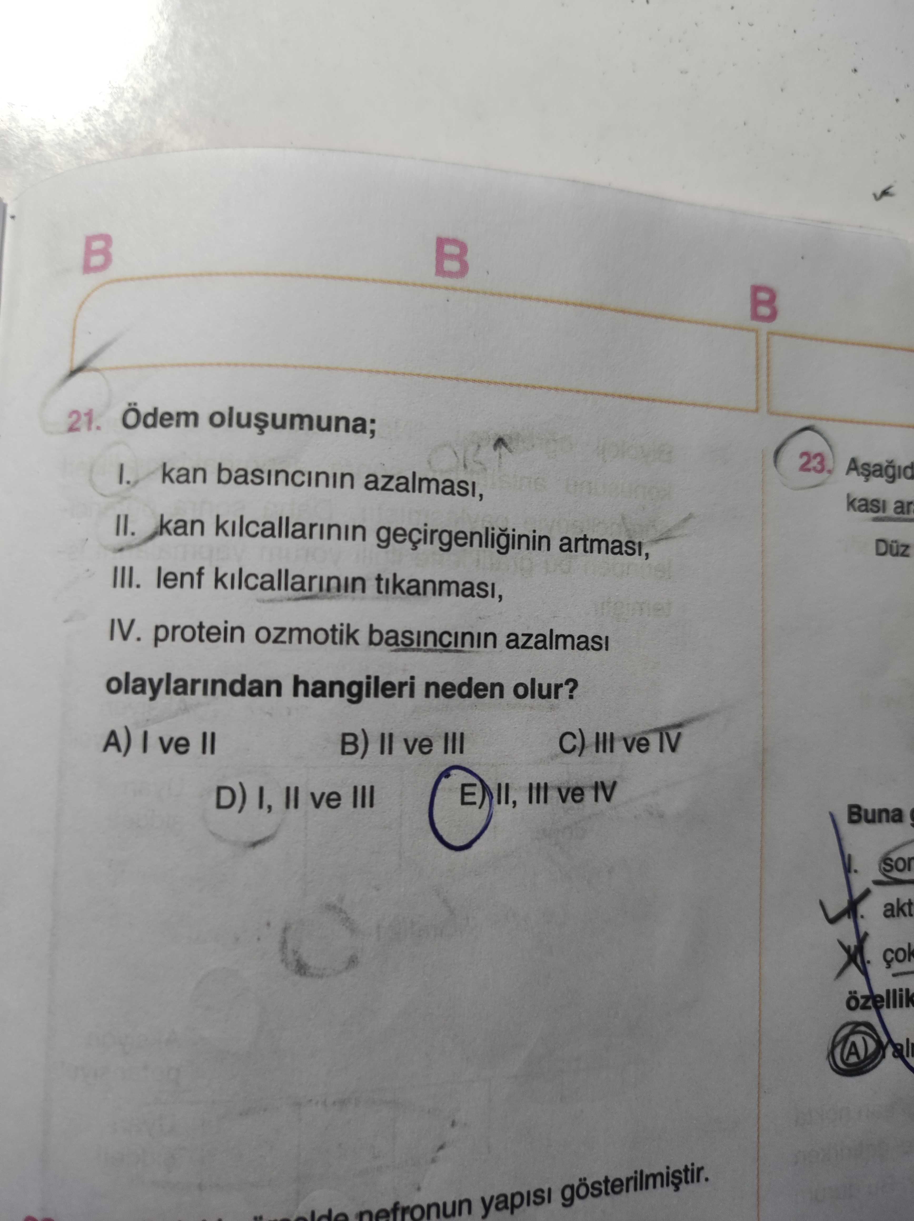 Ödem oluşumuna; I. kan basıncının azalması, II. kan kılcallarının geçirgenliğinin artması, III. lenf