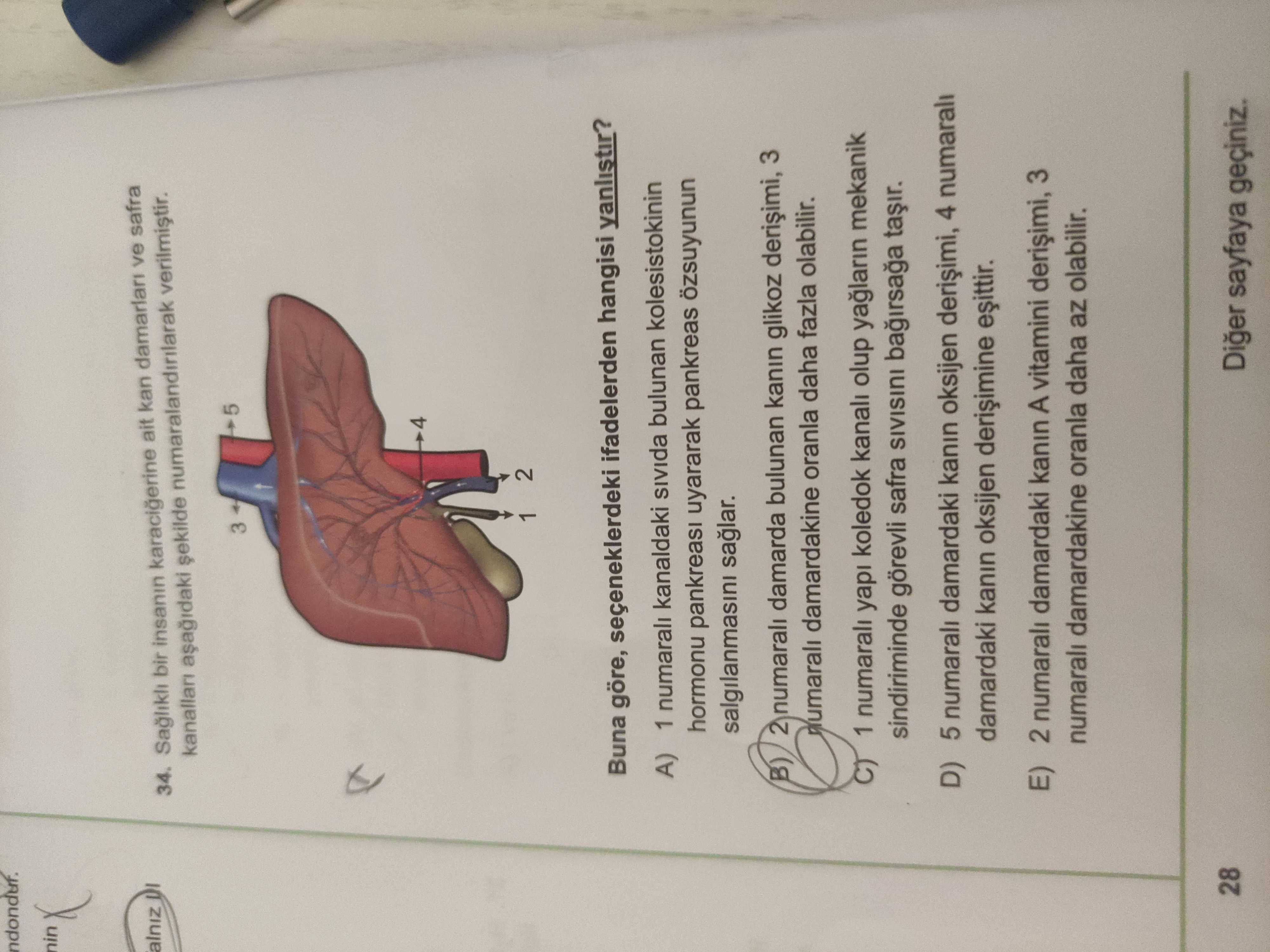 Sağlıklı bir insanın karaciğerine ait kan damarlarları ve safra kanalları aşağıdaki şekilde