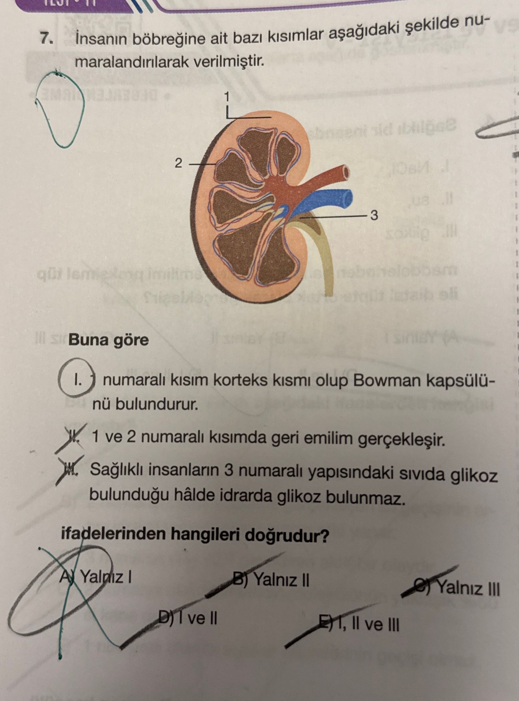 İnsanın böbreğine ait bazı kısımlar aşağıdaki şekilde numaralandırılarak verilmiştir. Buna göre I