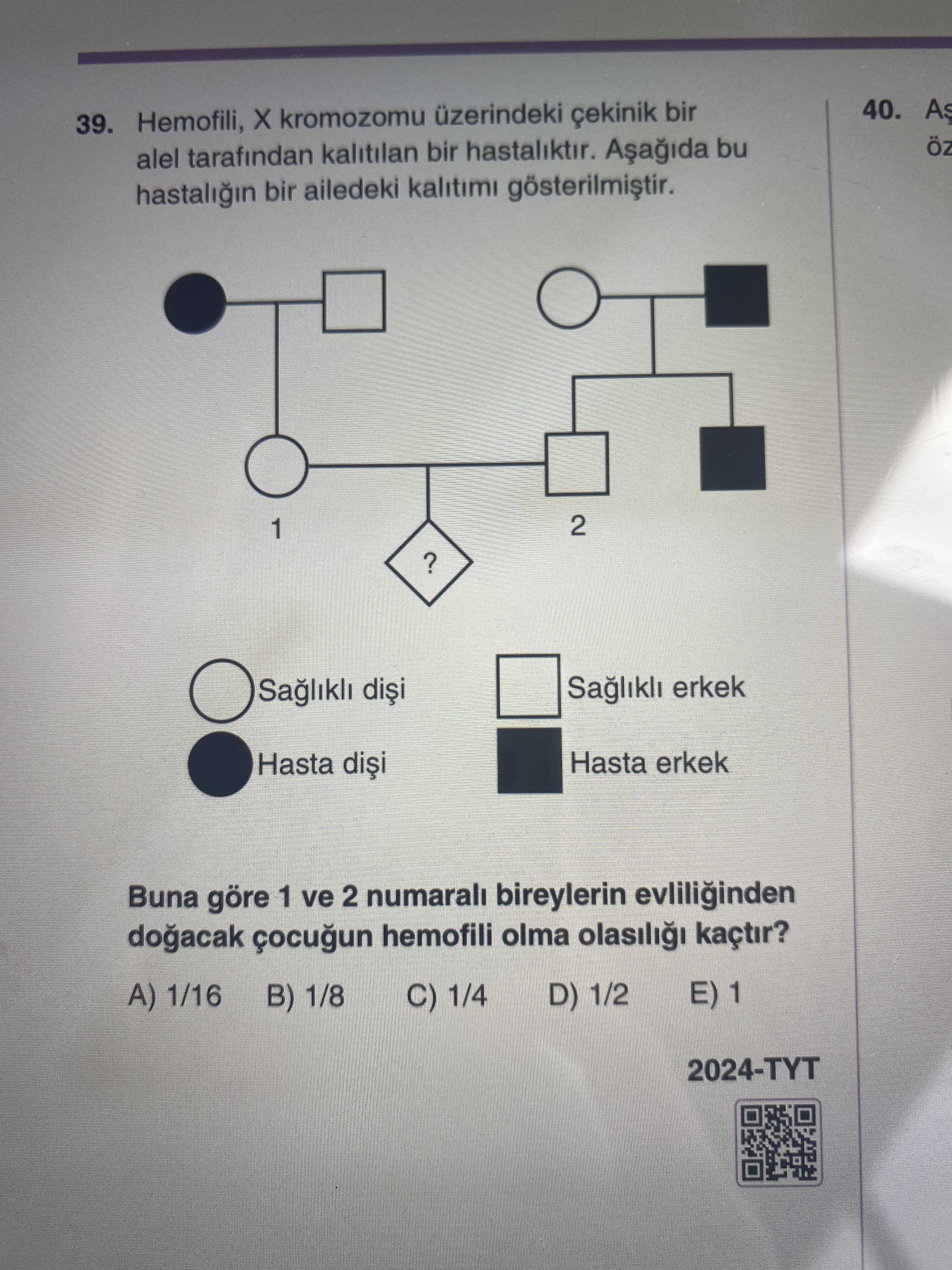 Hemofili, X kromozomu üzerindeki çekinik bir alel tarafından kalıtılan bir hastalıktır. Aşağıda bu