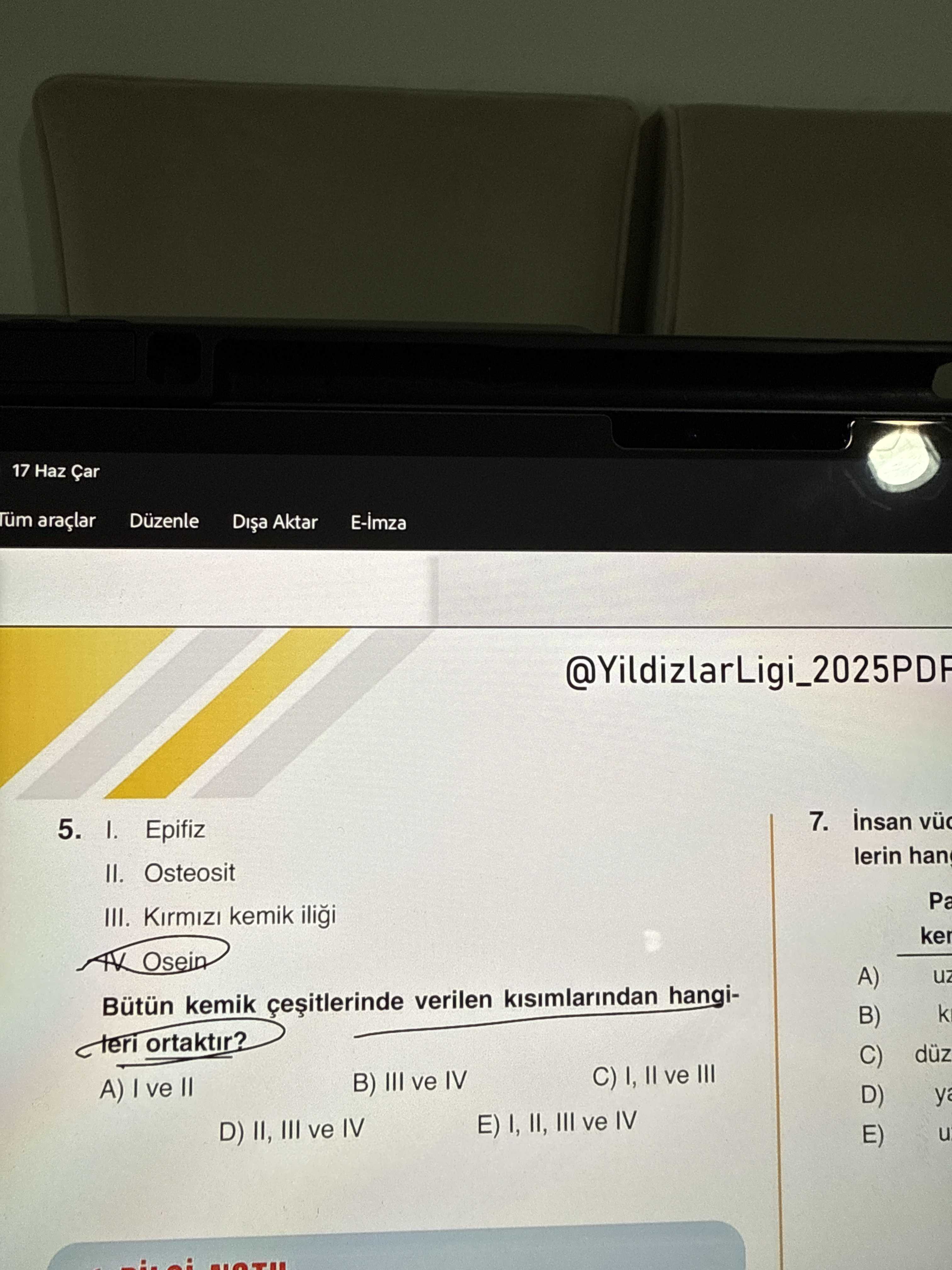I. Epifiz II. Osteosit III. Kırmızı kemik iliği IV. Osein Bütün kemik çeşitlerinde verilen