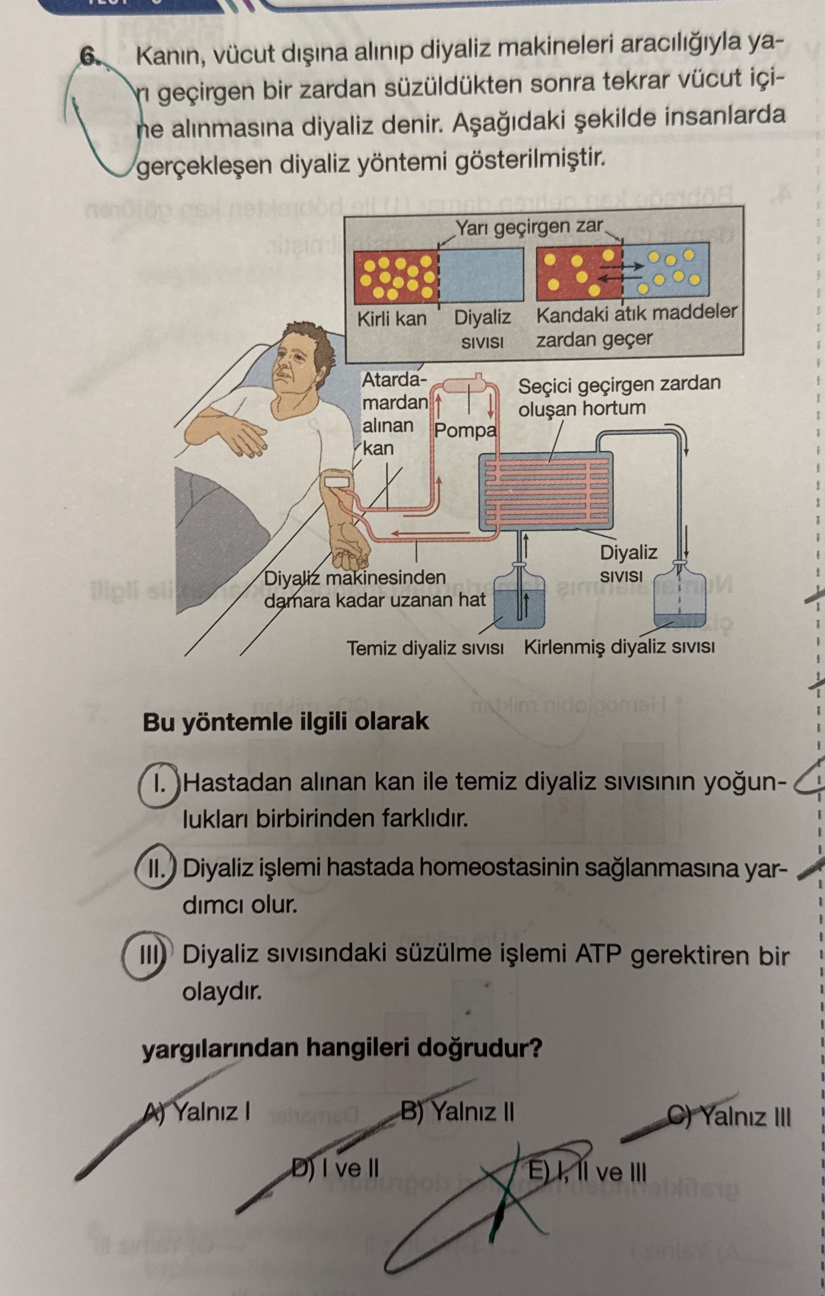 Kanın, vücut dışına alınıp diyaliz makineleri aracılığıyla yarı geçirgen bir zardan süzüldükten