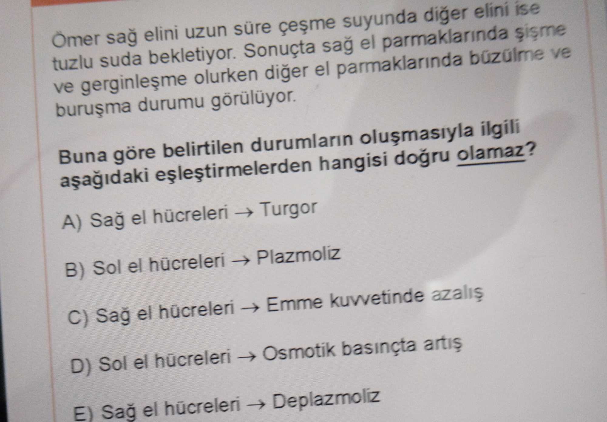 Ömer sağ elini uzun süre çeşme suyunda diğer elini ise tuzlu suda bekletiyor. Sonuçta sağ el parmaklarında şişme ve gerginleşme