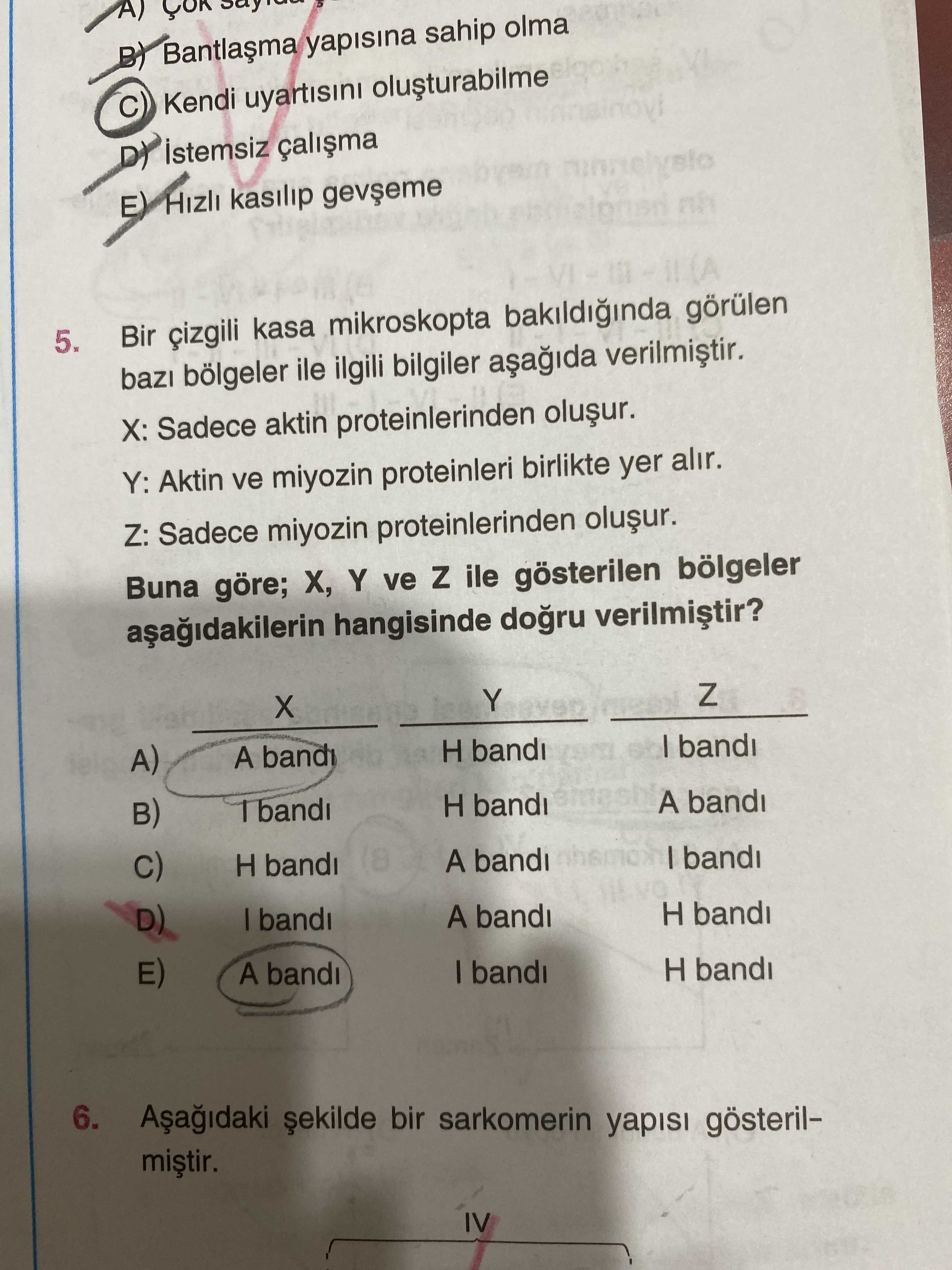 Bir çizgili kasa mikroskopta bakıldığında görülen bazı bölgeler ile ilgili bilgiler aşağıda