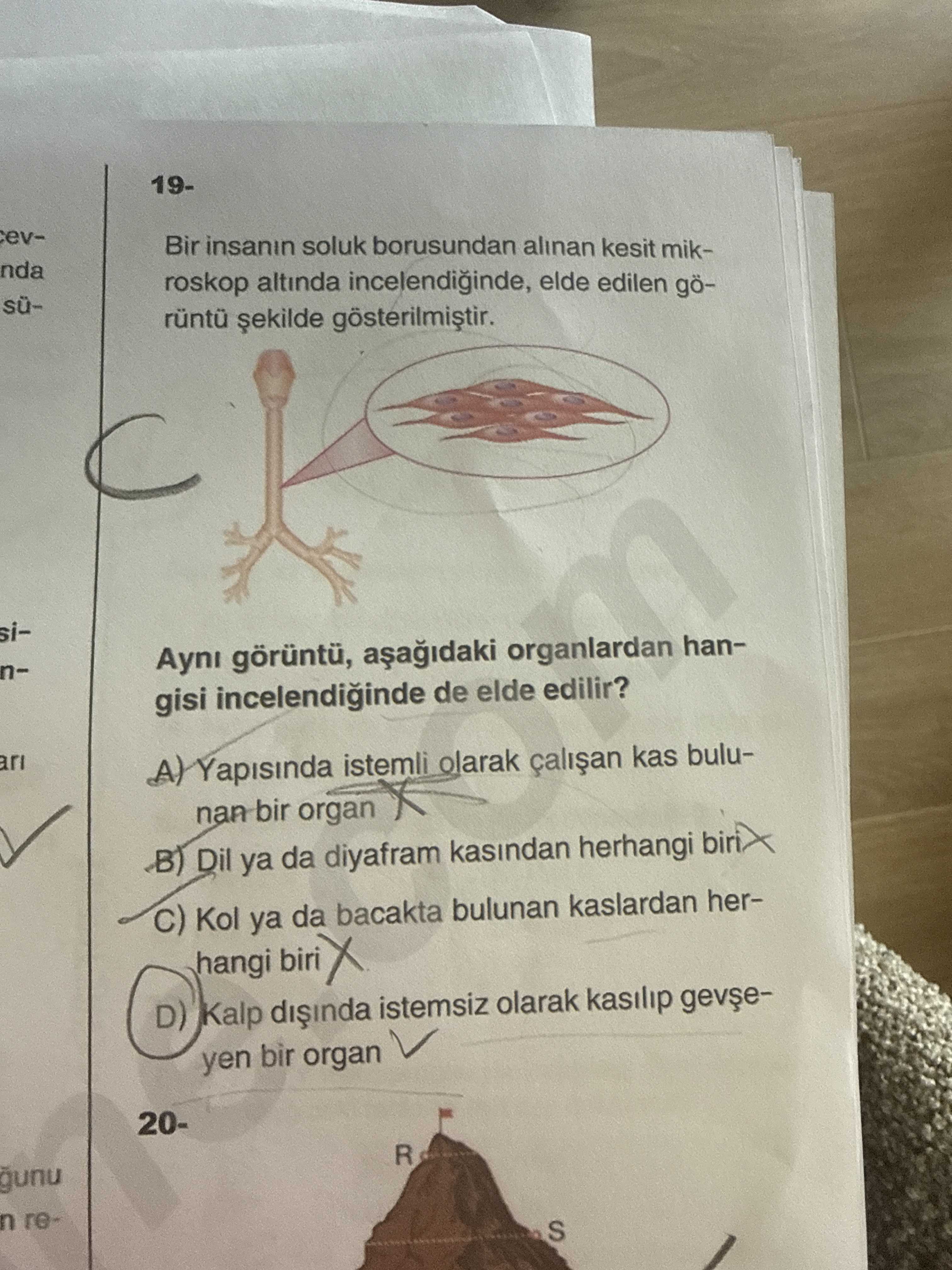 19- Bir insanın soluk borusundan alınan kesit mikroskop altında incelendiğinde, elde edilen görüntü