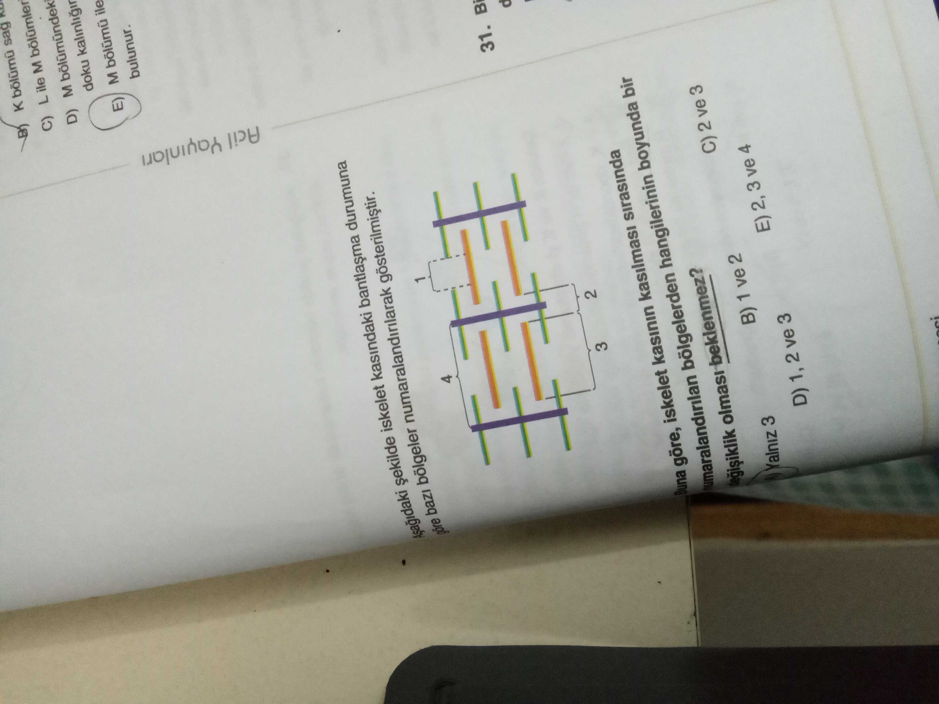 Aşağıdaki şekilde iskelet kasındaki bantlaşma durumuna göre bazı bölgeler numaralandırılarak
