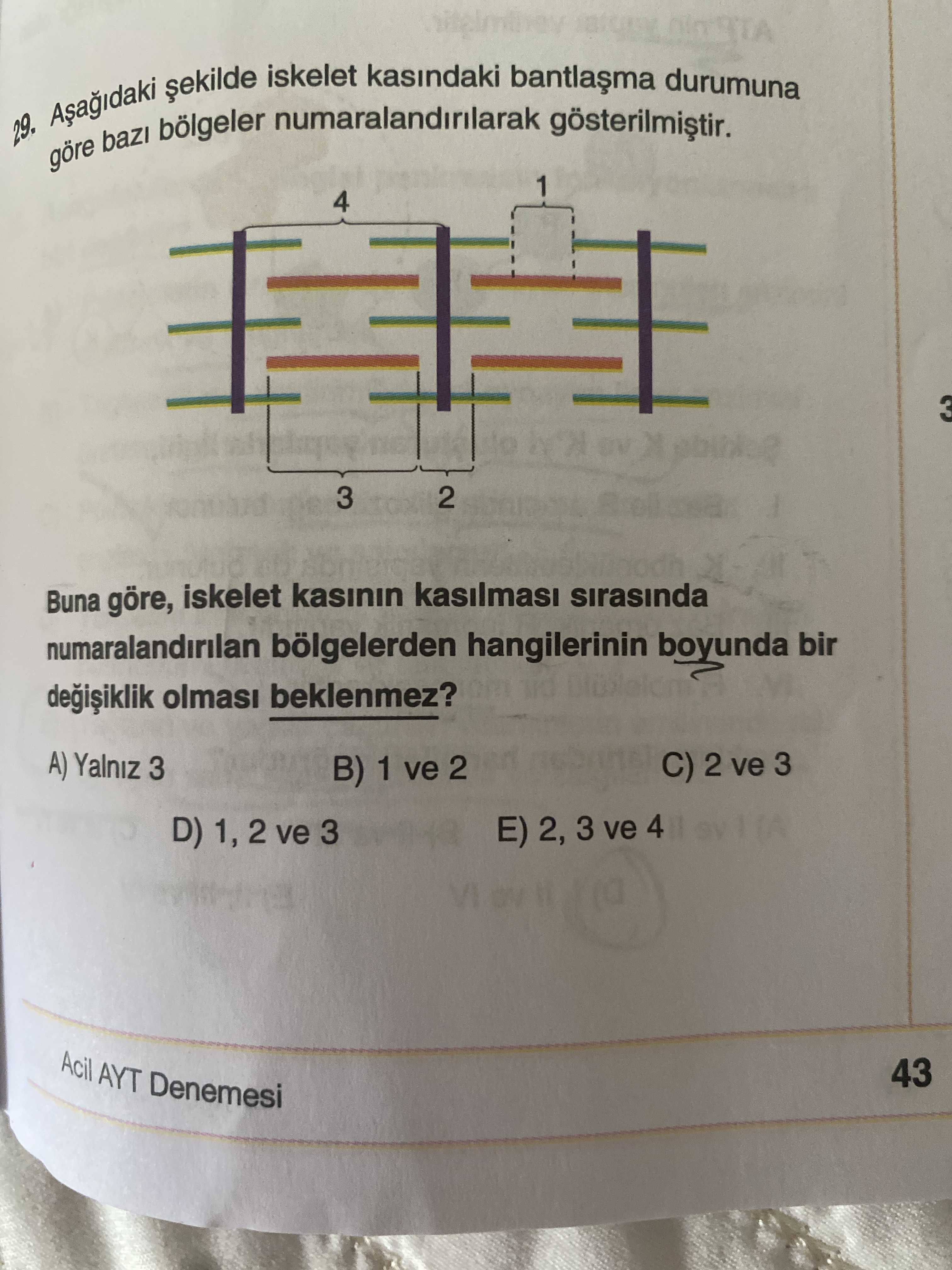 Aşağıdaki şekilde iskelet kasındaki bantlaşma durumuna göre bazı bölgeler numaralandırılarak